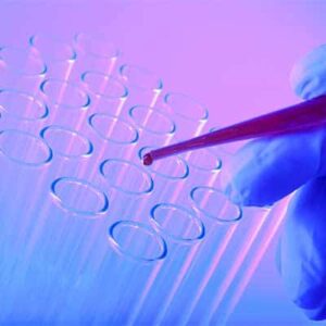 Le Contaminazioni da Virus alimentari e le infezioni virali