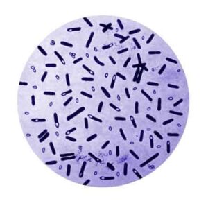 Clostridium botulinum guida alla prevenzione e gestione del botulino e botulismo