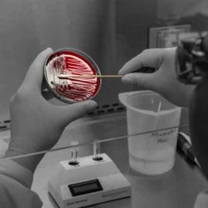 Listeria monocytogenes nell'industria alimentare