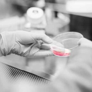 Pericolo Salmonella prevenzione e gestione nell'industria alimentare